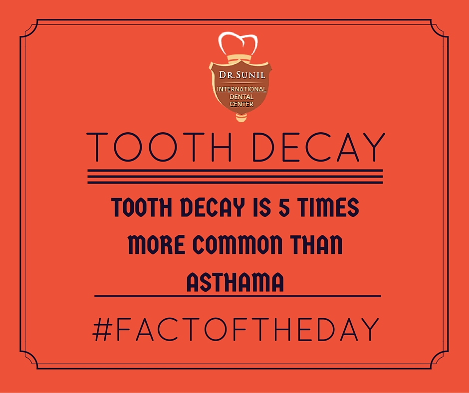 Fact of the day tooth decay