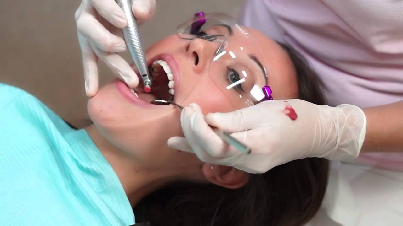 dentist teeth cleaning procedure