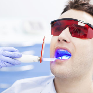 side effects laser teeth whitening treatment