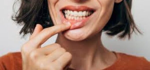 Gum Problems