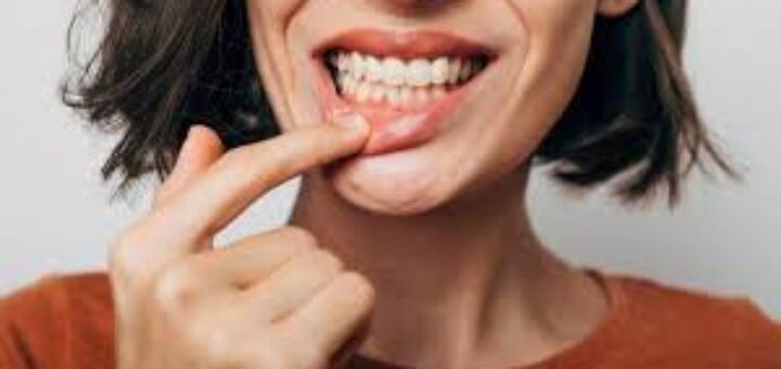 Gum Problems