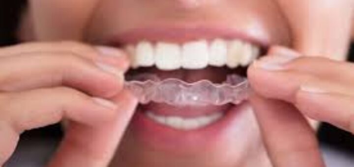 Teeth Grinding