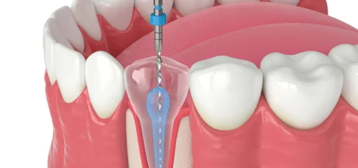 Endodontics