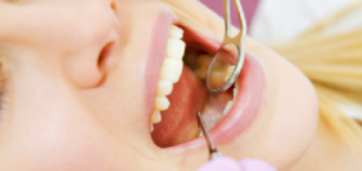 Root Canal Treatment Cost