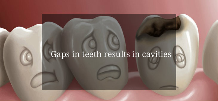 Cavity Myth Gap