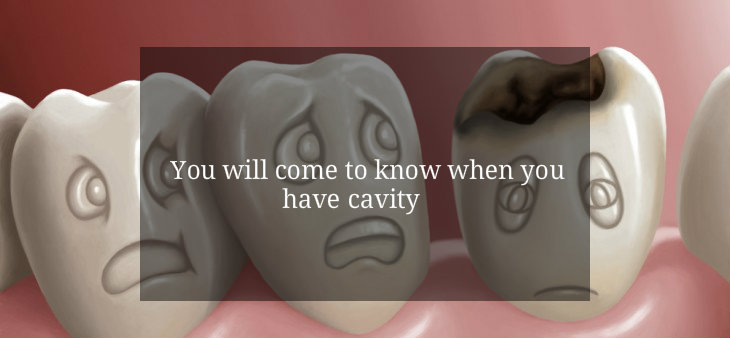 Cavity Myth