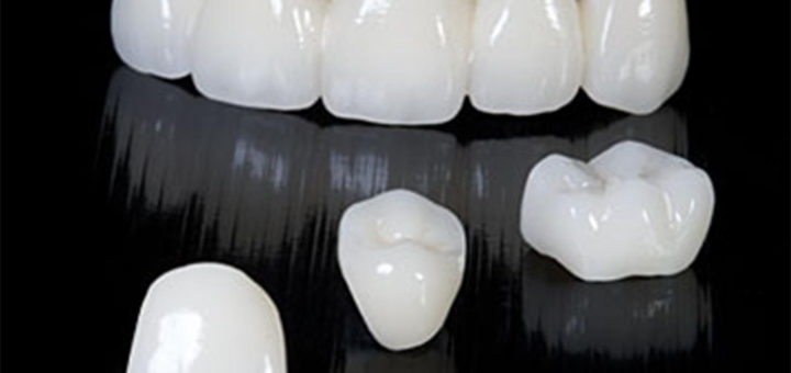 Ceramic Crowns