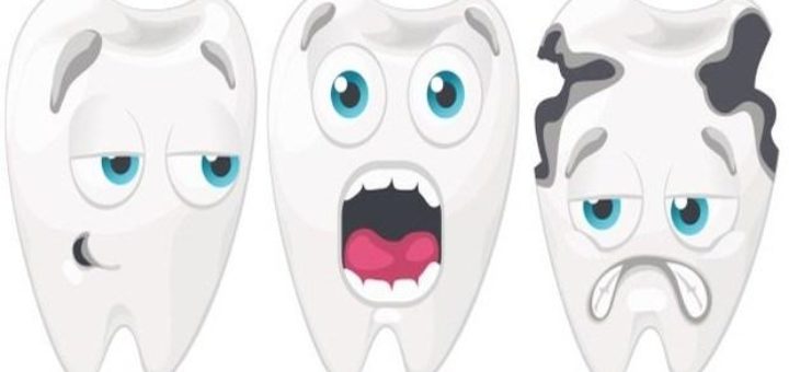 Dental Cavities