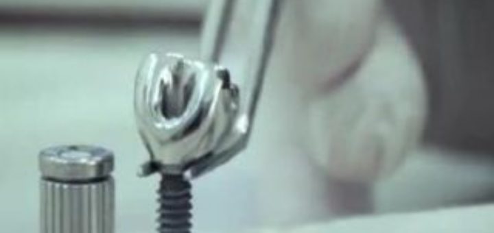 Tooth Implant