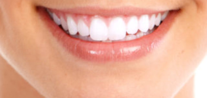 Dental Bonding