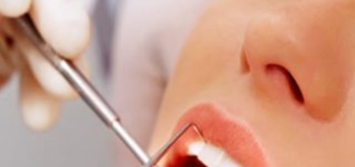 Dental Caries