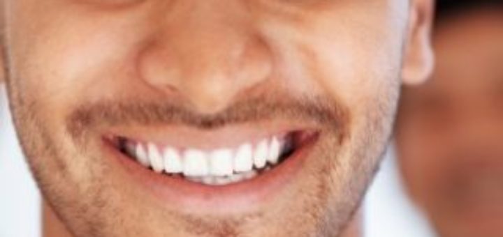 Dental Whitening