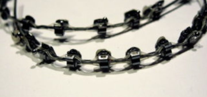 Dental Braces