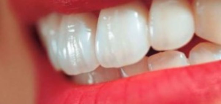 Get your teeth checked in Thailand next time