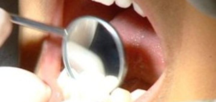 Facts about Dentistry