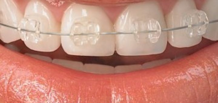 Orthodontics