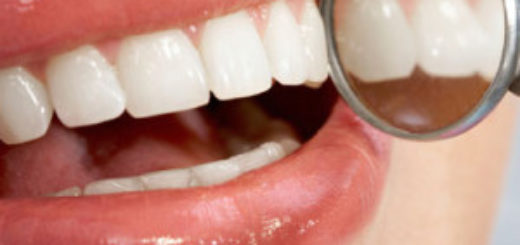 Laser Teeth Whitening Cost