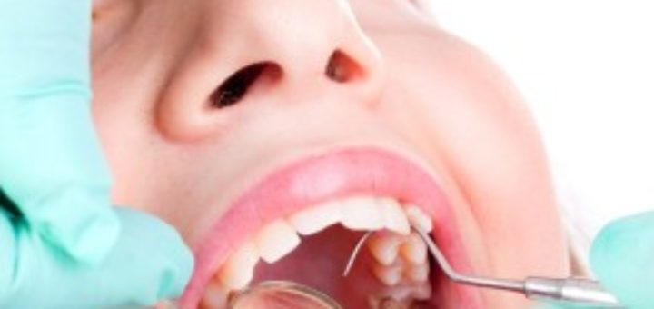 Gum Disease Treatment