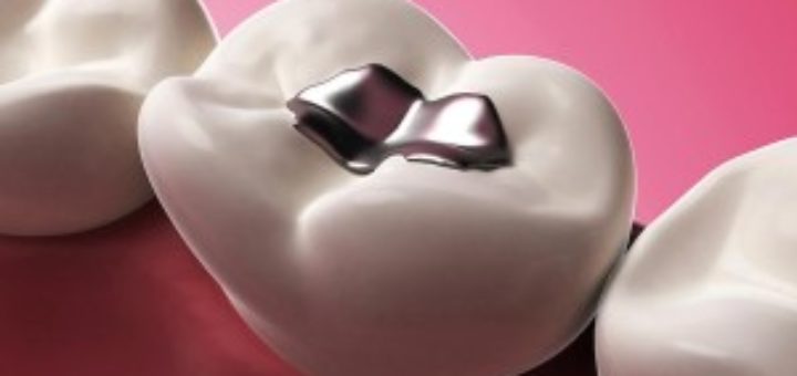 Holistic Dentistry: Powerful Path to a Healthier Smile