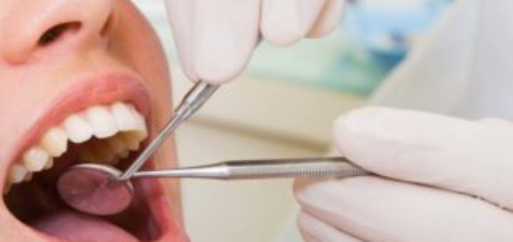 Overdentures
