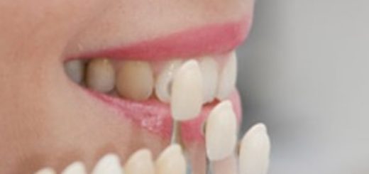 Porcelain Teeth