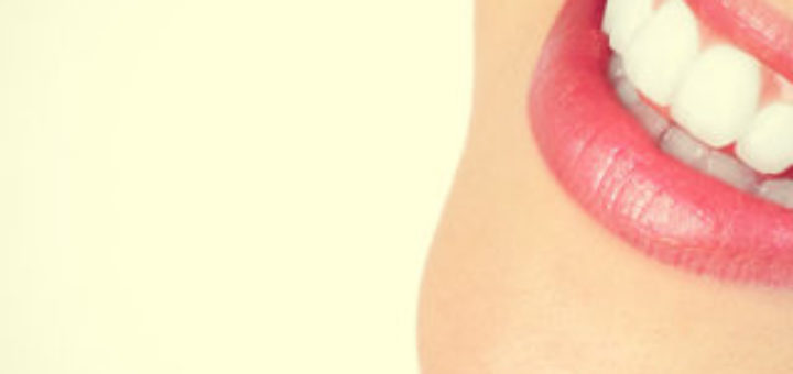 Cosmetic Gum Lift