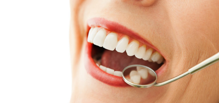 Dental Crown