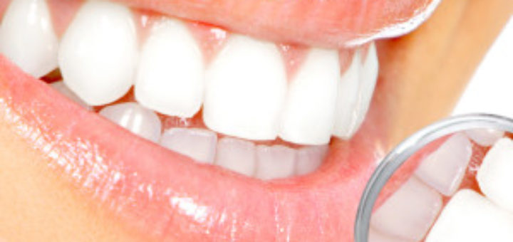 Tooth Decay