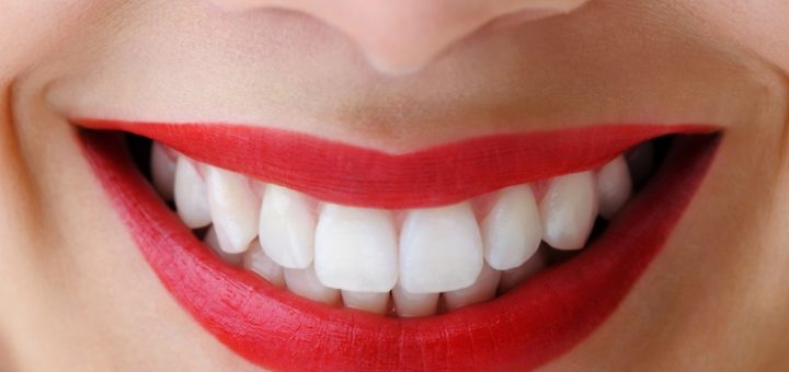 Dental Whitening