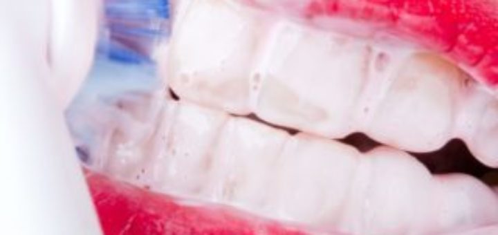 Dental Cleaning