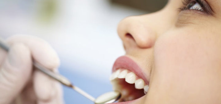 Dental Fillings