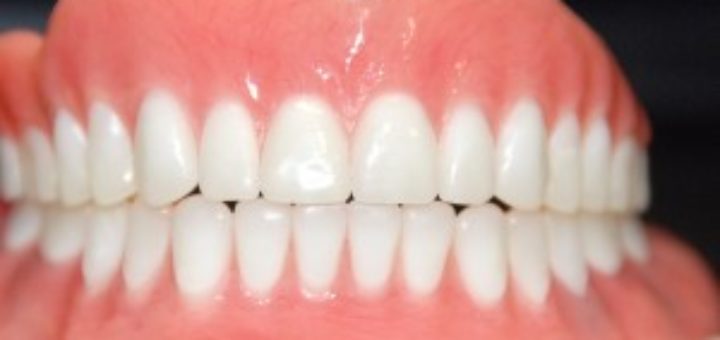 Dentures cost