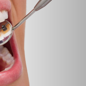Straight Wire Braces help in Straight Teeth - Dr Sunil Dental Blog