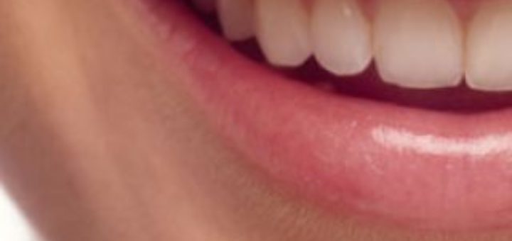 Oral Health