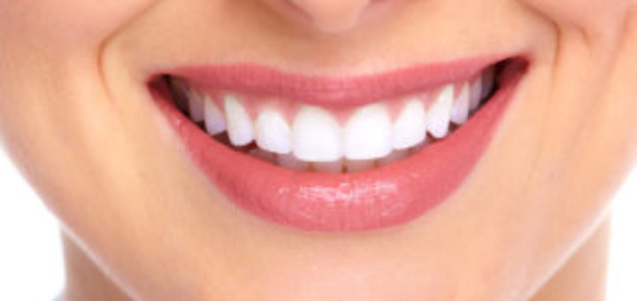 Smile Makeover