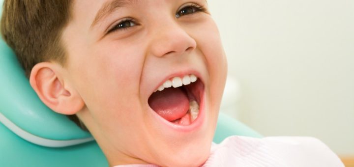 Cavities