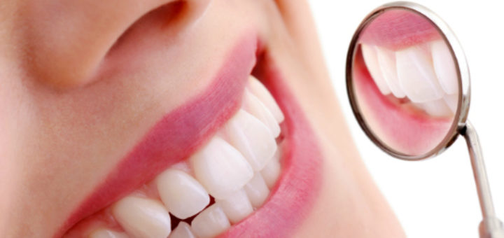Dental Erosion