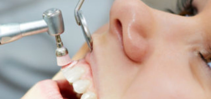 Dental Cleaning