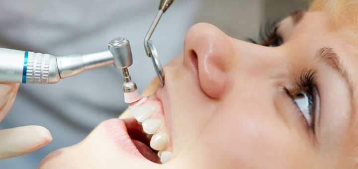 Dental Crown Treatment