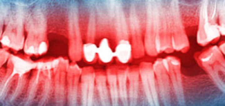 Dentistry in Thailand