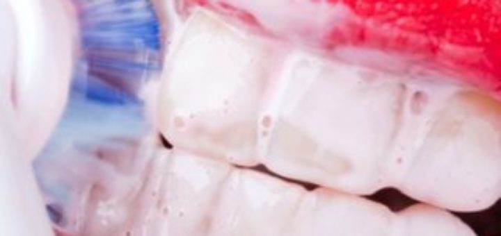 Tooth Polishing