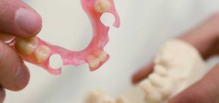 Valplast Dentures