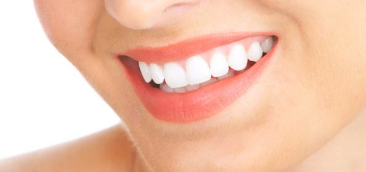 Tooth Whitening