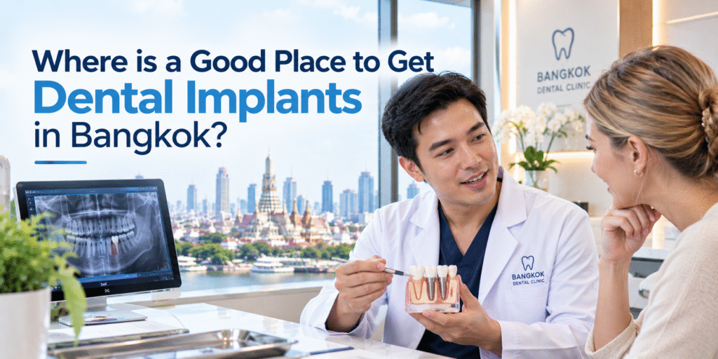 Where is a Good Place to Get Dental Implants in Bangkok?