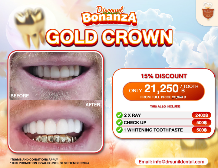 Porcelain Gold Crown