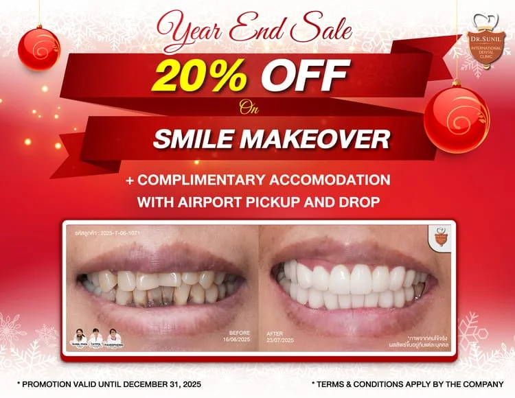 dental crown makeover