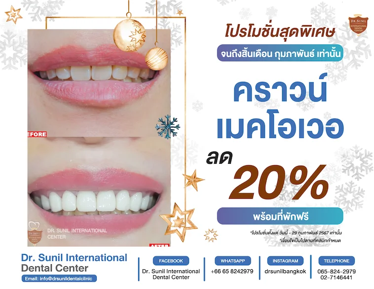 Dental Crown Offer