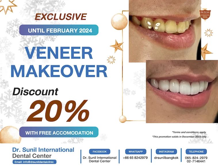 Dental Veneer Offer